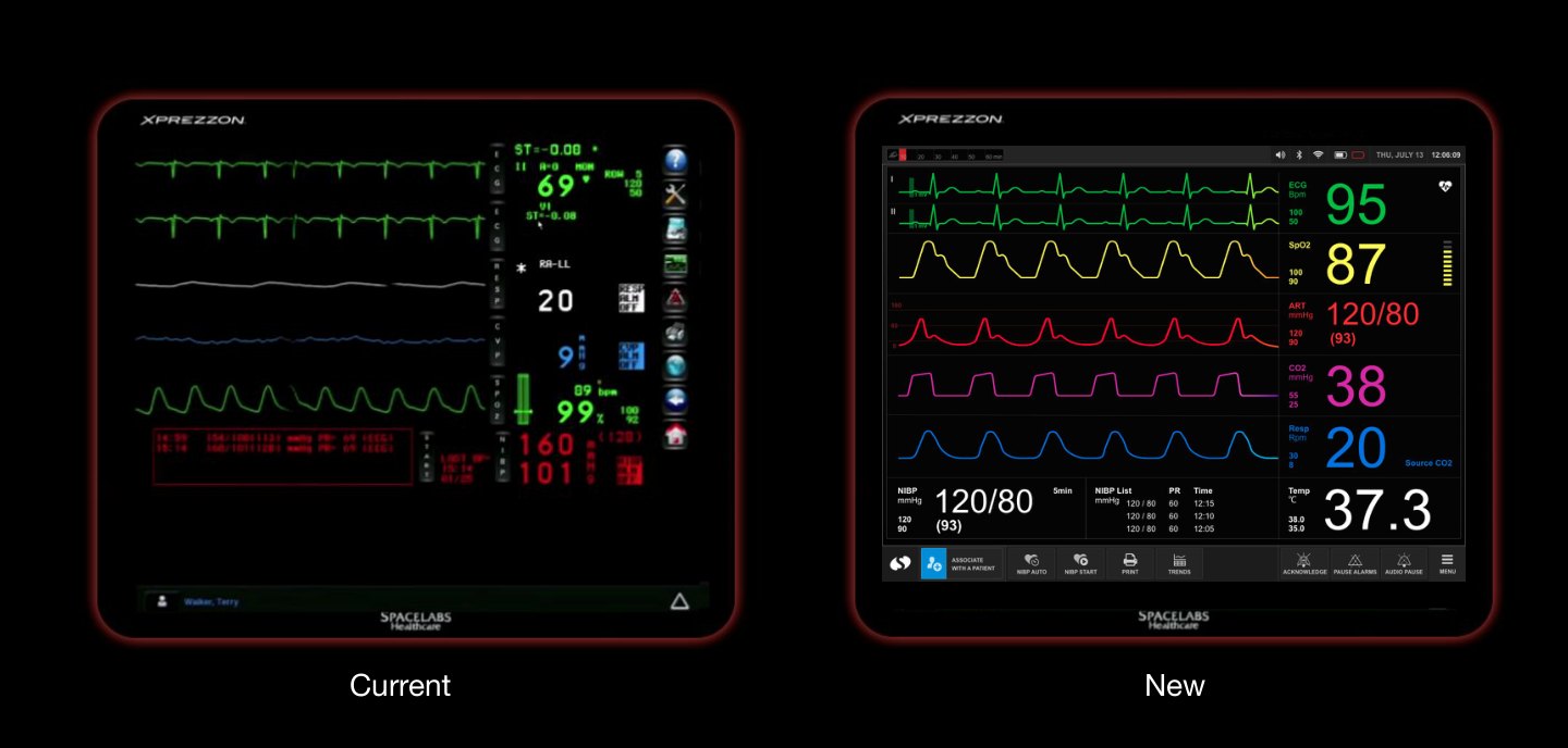 Comparison of the current monitor and the new concept
