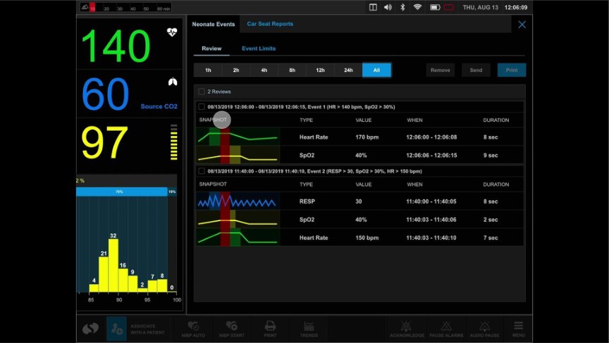 Patient monitor vital signs surveillance interface